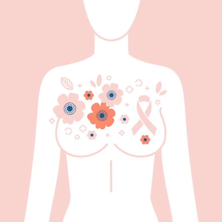 Read more about the article Why I Chose a Bi-Lateral Mastectomy